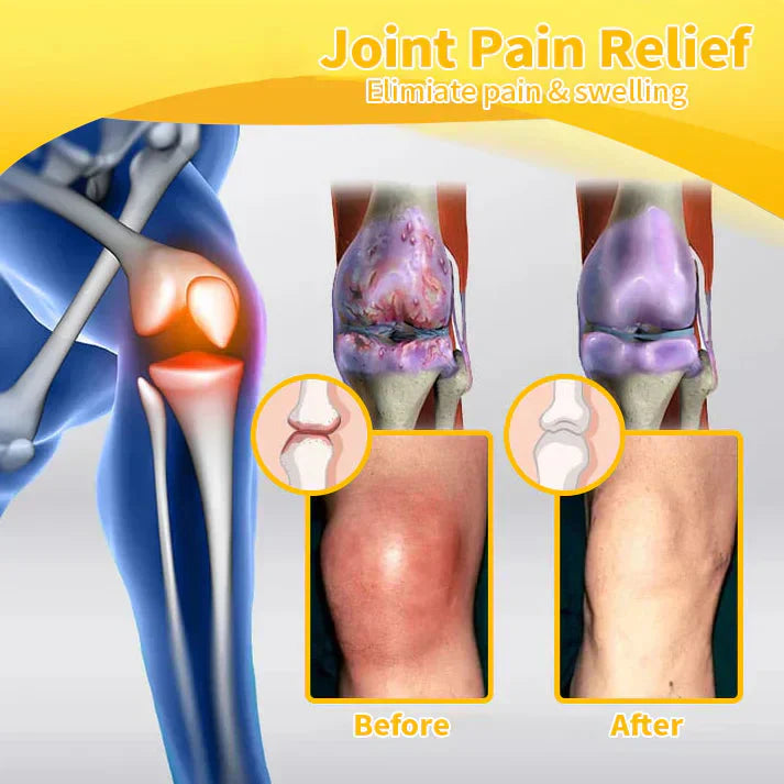 🇺🇸Official Store: flysmus™ Bee-Venom Pain-Relief Bone Healing Cream👨⚕️FDA Certified