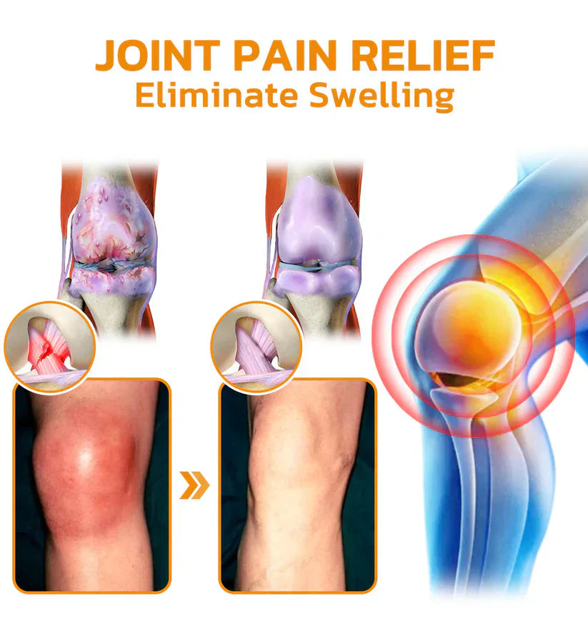 🇺🇸Official Store: flysmus™ Bee-Venom Pain-Relief Bone Healing Cream👨⚕️FDA Certified