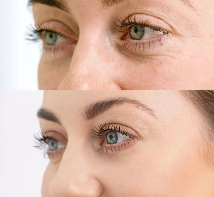100% VOLUFILINE 3D Repair Depuffing Eye Serum