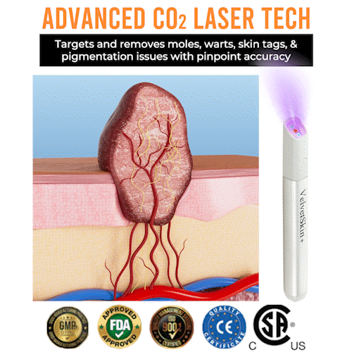 ๐บ๐ธBikendaยฎ ๐ฑ๐๐๐๐๐๐ฎ๐๐พ๐+ All-in-One Laser Eraser Pen (Powered by COโ laser technology)