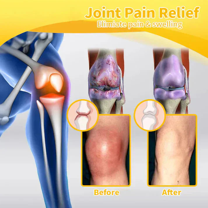 Made in an FDA-registered facility: Bee Venom Instant Ultra Strength Pain Relief Therapy Cream🇺🇸