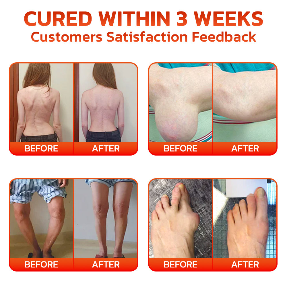 🧑‍🔬Made in an FDA-registered facility: Therma Core 𝗖𝗕𝗗 Capsaicin Instant Pain Relief Bone Healing Cream🌿🌶️