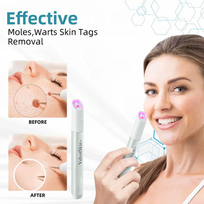 🇺🇸Bikenda® 𝒱𝑒𝓁𝓋𝑒𝓉𝒮𝓀𝒾𝓃+ All-in-One Laser Eraser Pen (Powered by CO₂ laser technology)