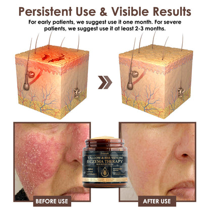Zvoevo® Tallow Bee Venom Skin Restoration Cream (Made in USA🇺🇸)