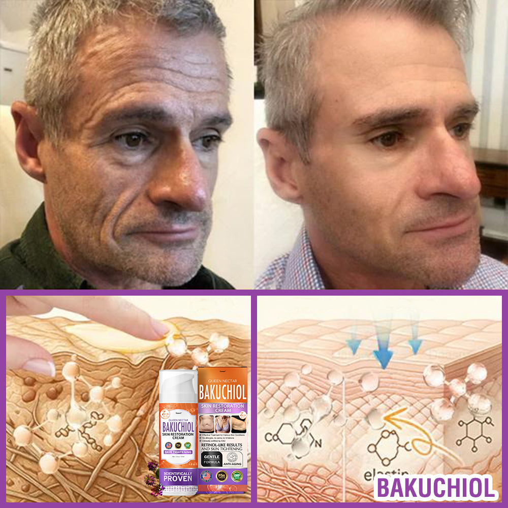 🇺🇸Made in an FDA-Registered Facility: 𝐅𝐮𝐫𝐳𝐞𝐫𝐨® 𝐐𝐮𝐞𝐞𝐧 𝐍𝐞𝐜𝐭𝐚𝐫 𝐏𝐞𝐩𝐭𝐢𝐝𝐞 + 𝐁𝐚𝐤𝐮𝐜𝐡𝐢𝐨𝐥 𝐒𝐤𝐢𝐧 𝐑𝐞𝐬𝐭𝐨𝐫𝐚𝐭𝐢𝐨𝐧 𝐂𝐫𝐞𝐚𝐦 - 𝐀𝐧𝐭𝐢-𝐚𝐠𝐢𝐧𝐠, 𝐇𝐲𝐝𝐫𝐚𝐭𝐢𝐧𝐠, 𝐒𝐤𝐢𝐧 𝐅𝐢𝐫𝐦𝐢𝐧𝐠 & 𝐋𝐢𝐟𝐭𝐢𝐧𝐠, 𝐒𝐤𝐢𝐧 𝐑𝐞𝐩𝐚𝐢𝐫, 𝐄𝐯𝐞𝐧 𝐓𝐨𝐧𝐞
