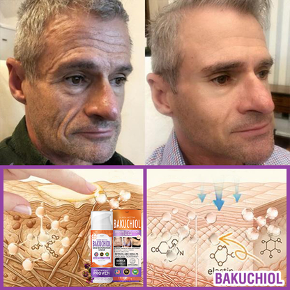 🇺🇸Made in an FDA-Registered Facility: 𝐅𝐮𝐫𝐳𝐞𝐫𝐨® 𝐐𝐮𝐞𝐞𝐧 𝐍𝐞𝐜𝐭𝐚𝐫 𝐏𝐞𝐩𝐭𝐢𝐝𝐞 + 𝐁𝐚𝐤𝐮𝐜𝐡𝐢𝐨𝐥 𝐒𝐤𝐢𝐧 𝐑𝐞𝐬𝐭𝐨𝐫𝐚𝐭𝐢𝐨𝐧 𝐂𝐫𝐞𝐚𝐦 - 𝐀𝐧𝐭𝐢-𝐚𝐠𝐢𝐧𝐠, 𝐇𝐲𝐝𝐫𝐚𝐭𝐢𝐧𝐠, 𝐒𝐤𝐢𝐧 𝐅𝐢𝐫𝐦𝐢𝐧𝐠 & 𝐋𝐢𝐟𝐭𝐢𝐧𝐠, 𝐒𝐤𝐢𝐧 𝐑𝐞𝐩𝐚𝐢𝐫, 𝐄𝐯𝐞𝐧 𝐓𝐨𝐧𝐞