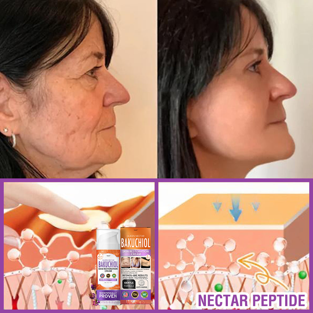 🇺🇸Made in an FDA-Registered Facility: 𝐅𝐮𝐫𝐳𝐞𝐫𝐨® 𝐐𝐮𝐞𝐞𝐧 𝐍𝐞𝐜𝐭𝐚𝐫 𝐏𝐞𝐩𝐭𝐢𝐝𝐞 + 𝐁𝐚𝐤𝐮𝐜𝐡𝐢𝐨𝐥 𝐒𝐤𝐢𝐧 𝐑𝐞𝐬𝐭𝐨𝐫𝐚𝐭𝐢𝐨𝐧 𝐂𝐫𝐞𝐚𝐦 - 𝐀𝐧𝐭𝐢-𝐚𝐠𝐢𝐧𝐠, 𝐇𝐲𝐝𝐫𝐚𝐭𝐢𝐧𝐠, 𝐒𝐤𝐢𝐧 𝐅𝐢𝐫𝐦𝐢𝐧𝐠 & 𝐋𝐢𝐟𝐭𝐢𝐧𝐠, 𝐒𝐤𝐢𝐧 𝐑𝐞𝐩𝐚𝐢𝐫, 𝐄𝐯𝐞𝐧 𝐓𝐨𝐧𝐞