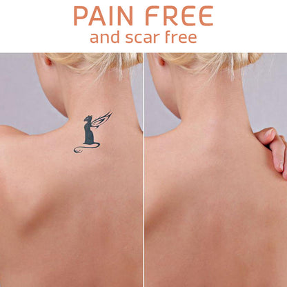 CleanTat Tattoo Removal Cream